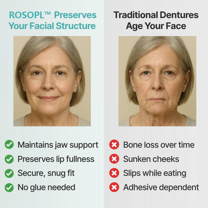 🦷NEYEROS® Advanced Functional Dentures - Get Your Smile Back With A Secure & Comfortable Fit