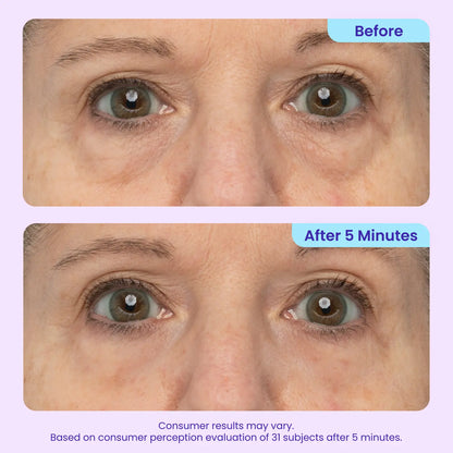 Instant Eye Lifting Gel
