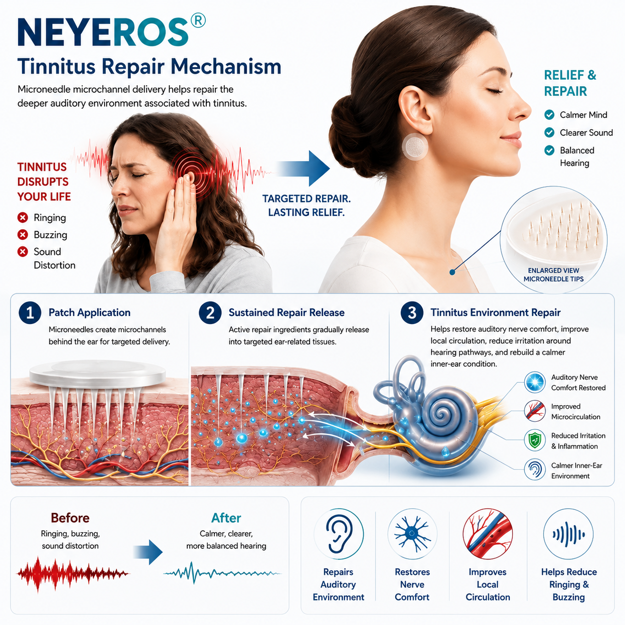 NEYEROS® HEARING REPAIR MICRONEEDLE PATCHES ✅ Targets Hearing Loss, Tinnitus, Ear Infections, Balance Disorders, and Age-Related Ear Degeneration.