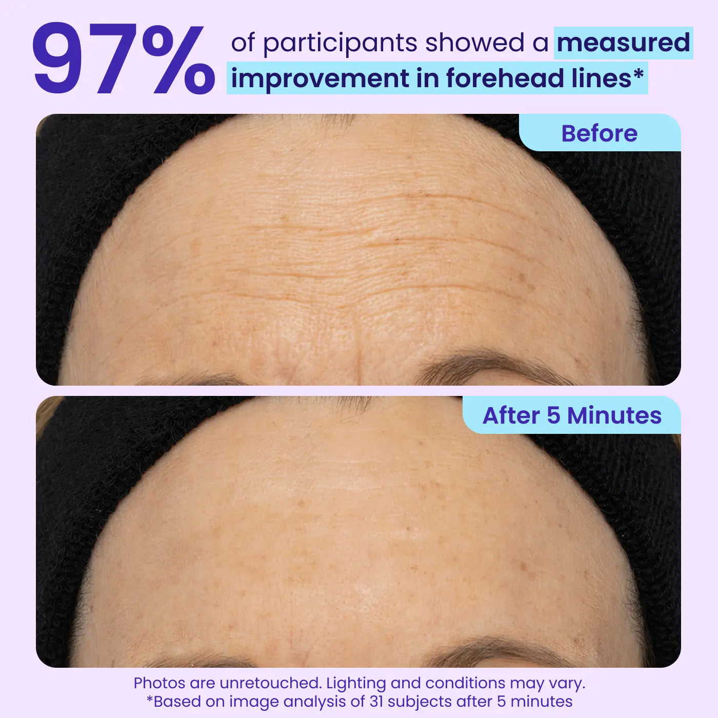 Instant Eye Lifting Gel