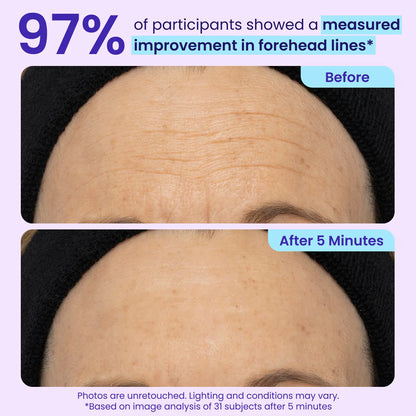 Instant Eye Lifting Gel