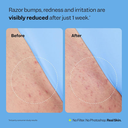 Body Care Roll-on