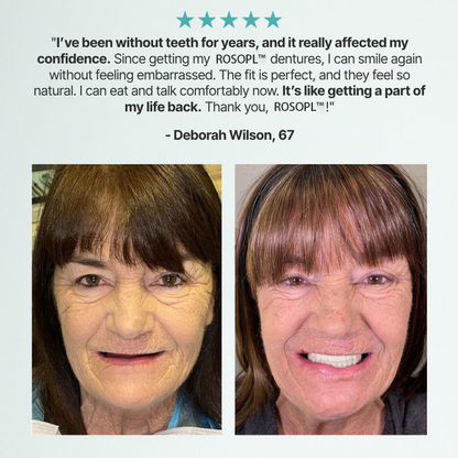 🦷NEYEROS® Advanced Functional Dentures - Get Your Smile Back With A Secure & Comfortable Fit